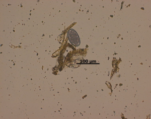 Ei von Trichostrongylus retortaeformis zweite AN 300x238 1