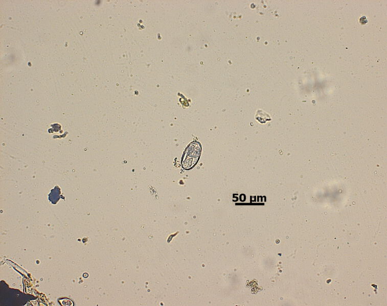 Eier von Graphidium strigosum mit Larve